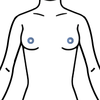 乳輪周囲