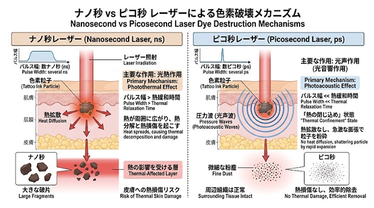光音響作用による低侵襲な色素破壊